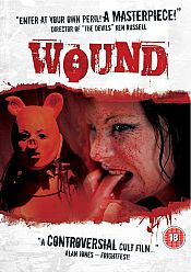 Wound